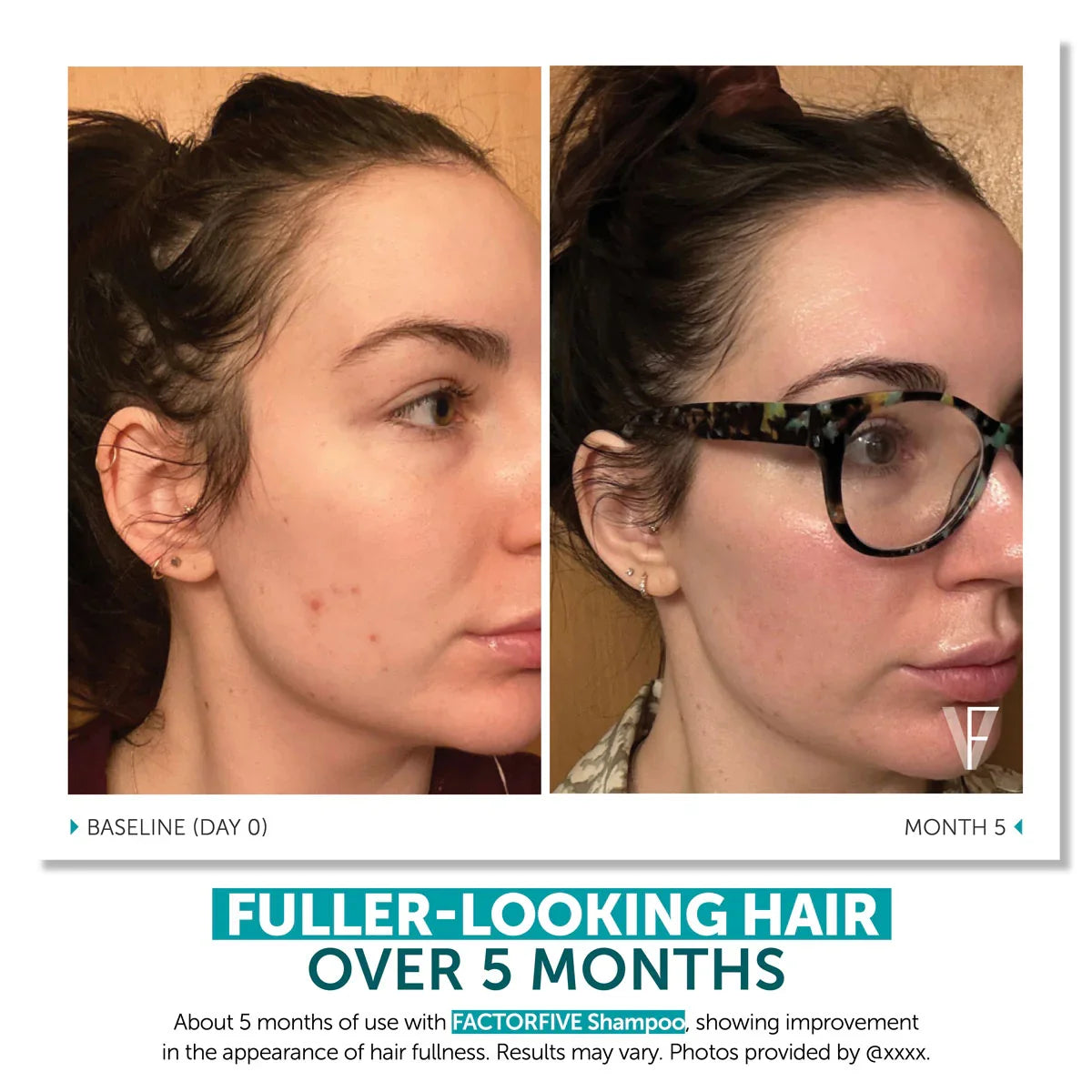 FACTORFIVE SHAMPOO ADVANCED HAIRCARE