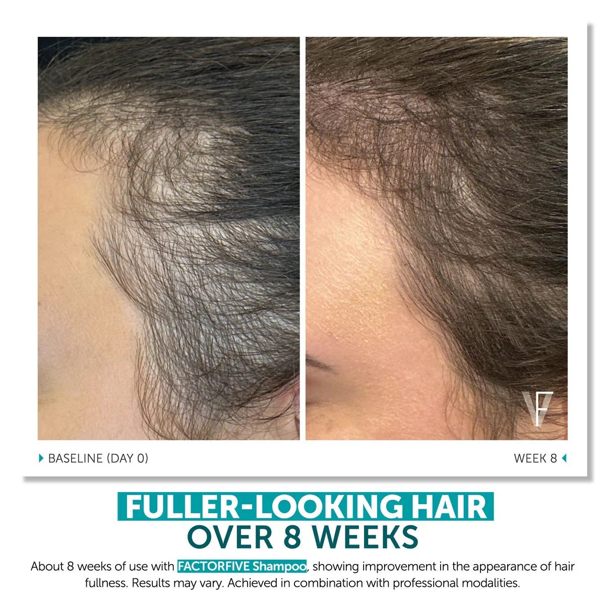 FACTORFIVE SHAMPOO ADVANCED HAIRCARE