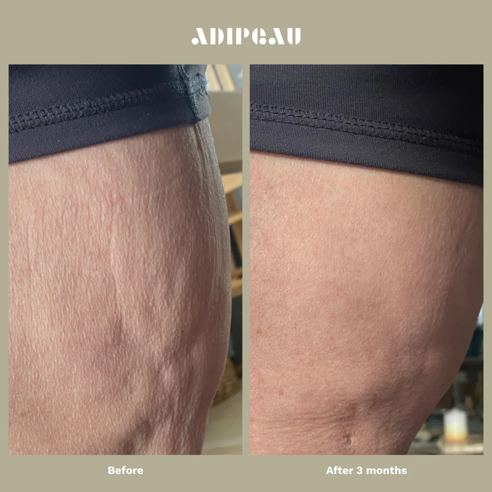 Strong Body Gel by Adipaeu
