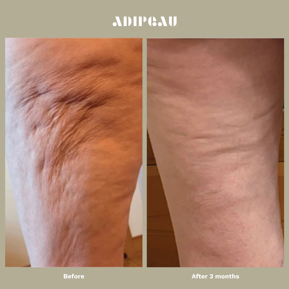 Strong Body Gel by Adipaeu