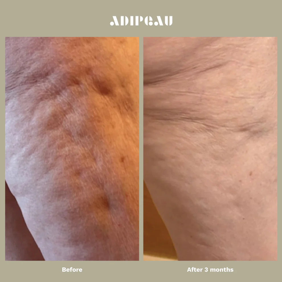 Strong Body Gel by Adipaeu